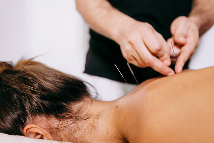 Acupuncturist inserting acupuncture needles into female patient’s back